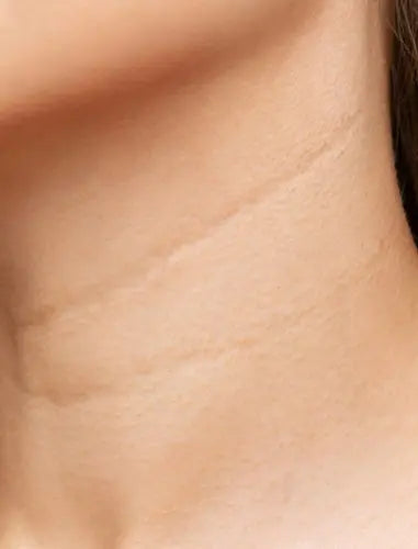Anti-Wrinkle & Hydrating Neck Mask