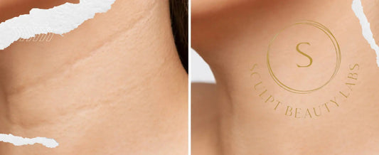 Anti-Wrinkle & Hydrating Neck Mask S Sculpt Beauty Labs